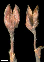 Veronica scopulorum. Capsules. Scale = 1 mm.
 Image: W.M. Malcolm © Te Papa CC-BY-NC 3.0 NZ